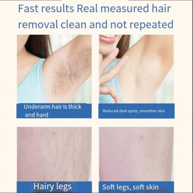 Shopdroplo IPL Laser Hair Removal Device for Women – Painless, Rechargeable, At-Home Epilator